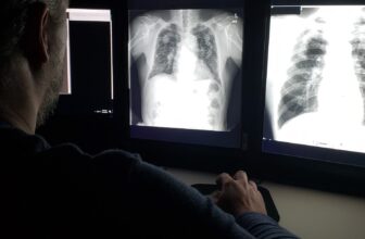 Lung Energy Peaks in Our 20s—and It is a Regular Decline From There, Examine Finds